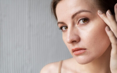 Pelle sensibile: come riconoscerla e come scegliere i cosmetici